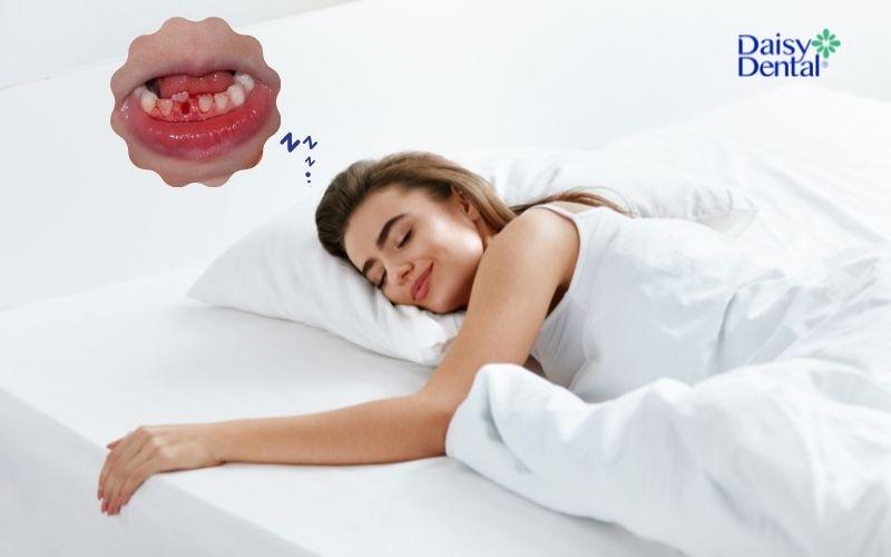 Nằm mơ thấy máu trong miệng